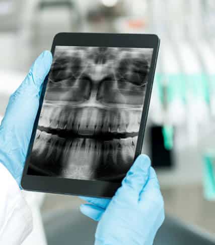 DIGITAL-X-RAY