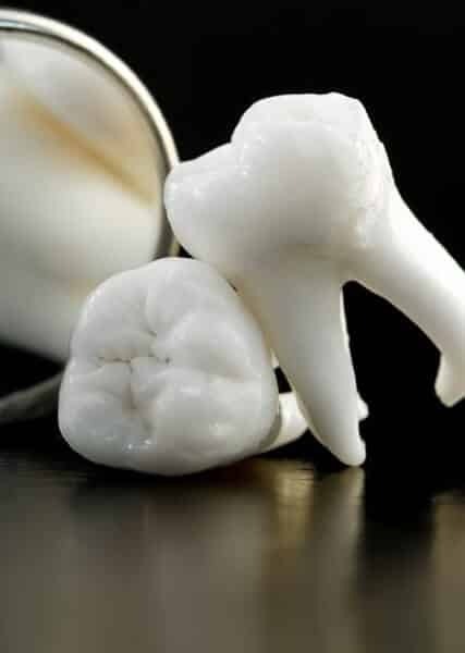 tooth replacement