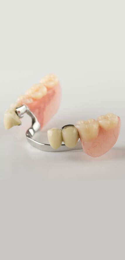 PARTIAL DENTURES