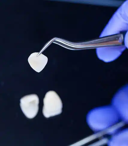 Dental implant being held with tweezers above two tooth-colored prosthetic components on dark surface.