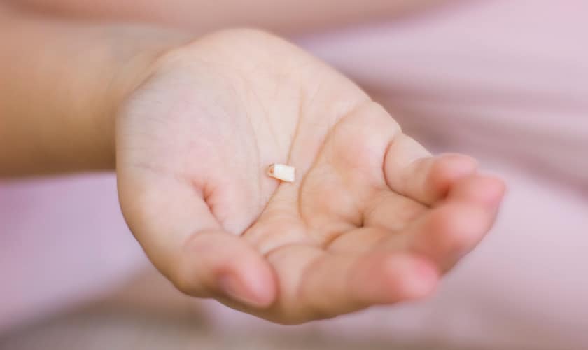 Tooth Replacement