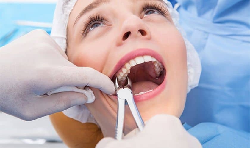 Preserving Your Smile: Exploring Alternatives to Tooth Extraction - Karr & Hardee Dentistry