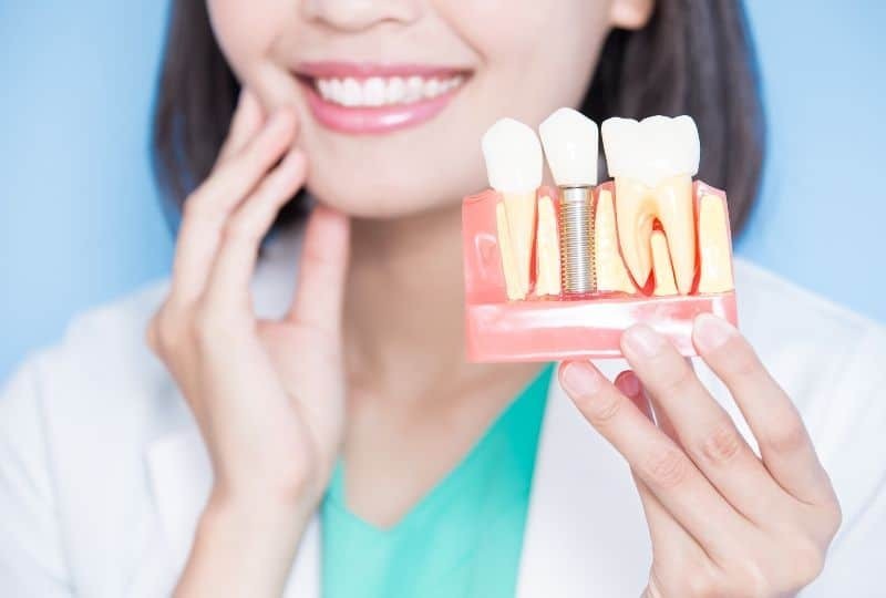7 Reasons to Choose Dental Implants Over Dentures