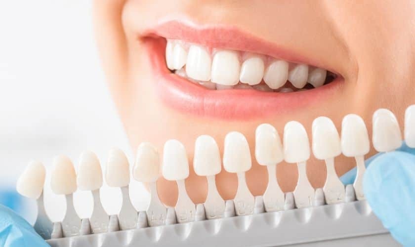 Teeth Whitening in Amarillo, TX