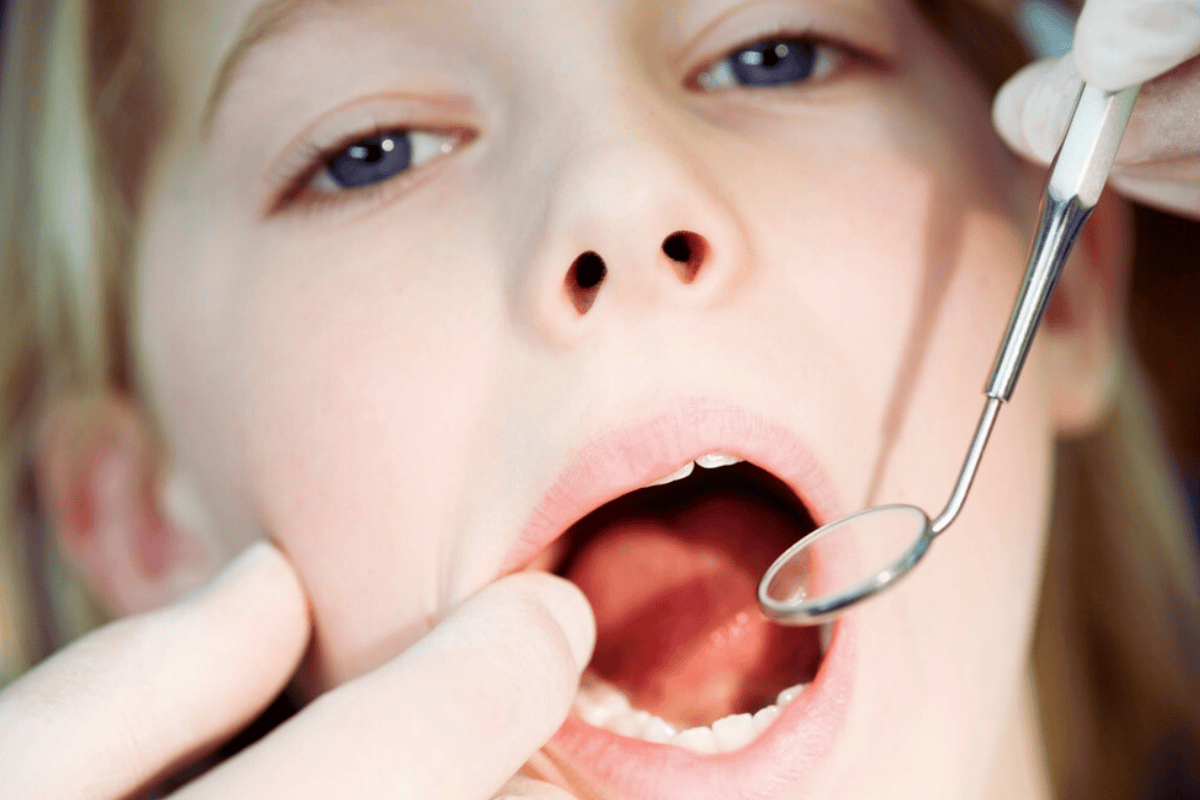 Is Nitrous Oxide Safe for Kids During Dental Procedures
