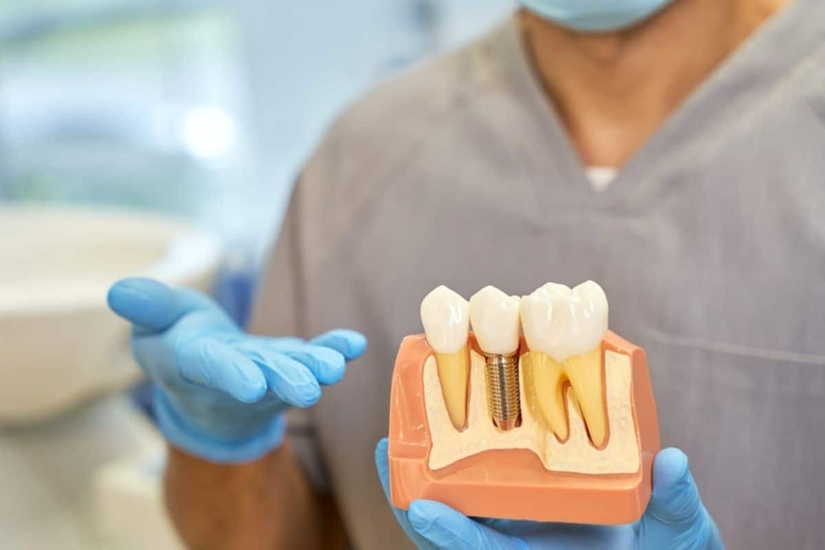 dentist offering dental implant for missing tooth replacement in Amarillo, TX
