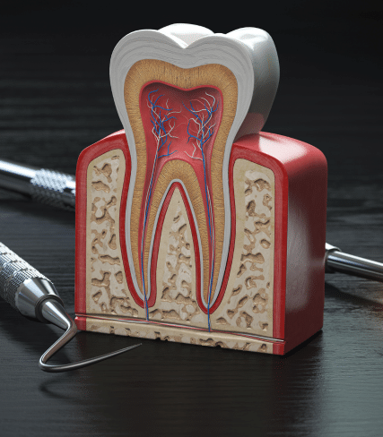 Model of tooth anatomy with dental tools