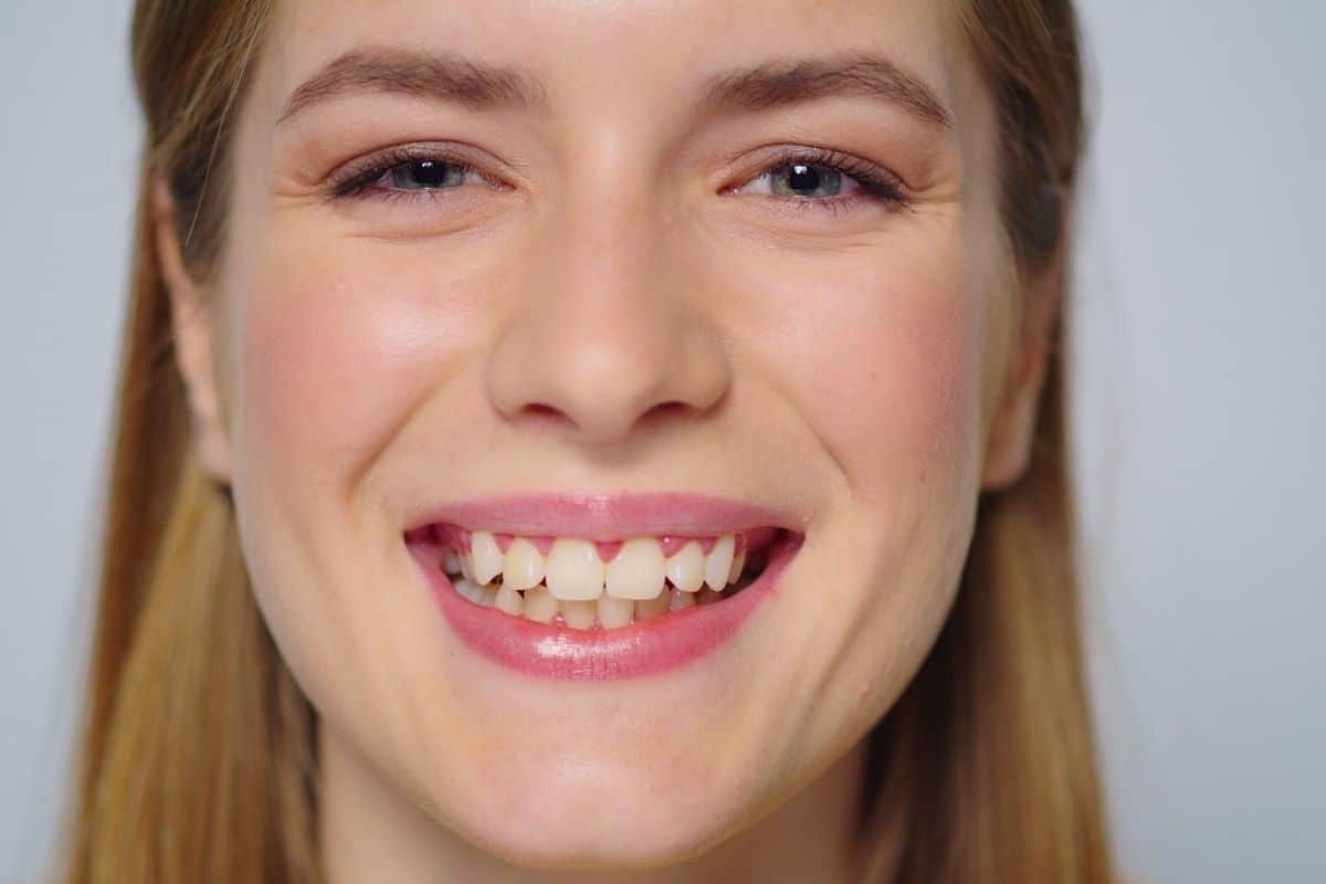 Featured image for “What Can Be Done For A Missing Tooth?”