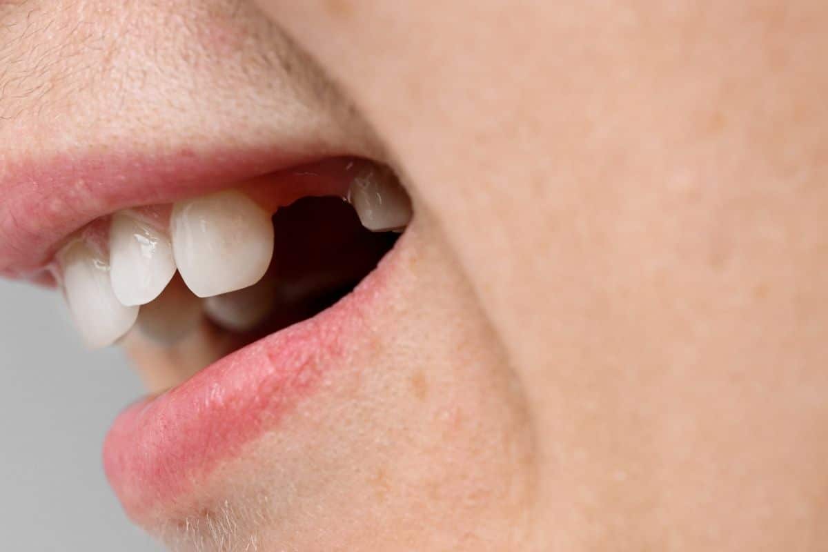 Featured image for “How Long Can You Go Without Replacing a Missing Tooth?”