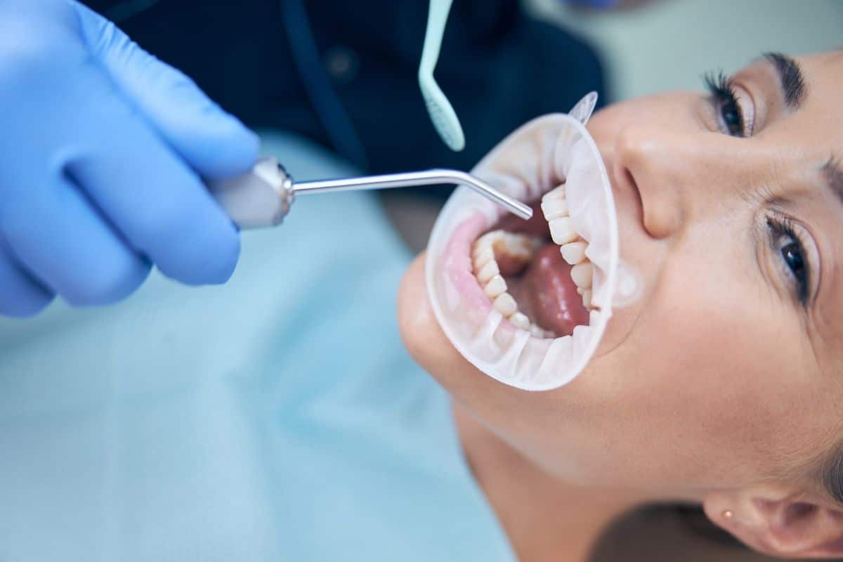 Featured image for “Does Skipping a Dental Cleaning Actually Matter?”